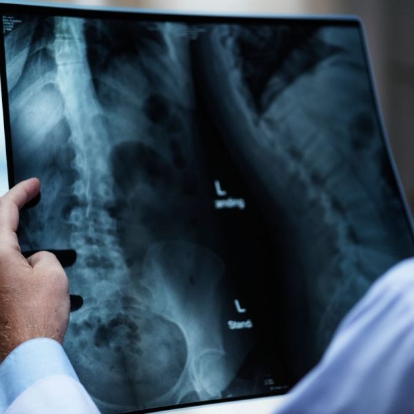 how to become a radiologist doctor