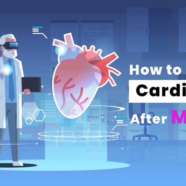 How to Become a Cardiologist After MBBS